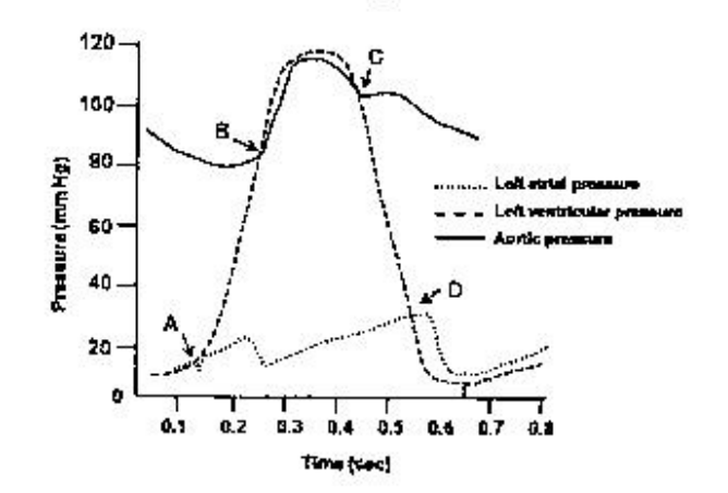 The changes in left atrial, left ventricular and aortic pressure in a ...